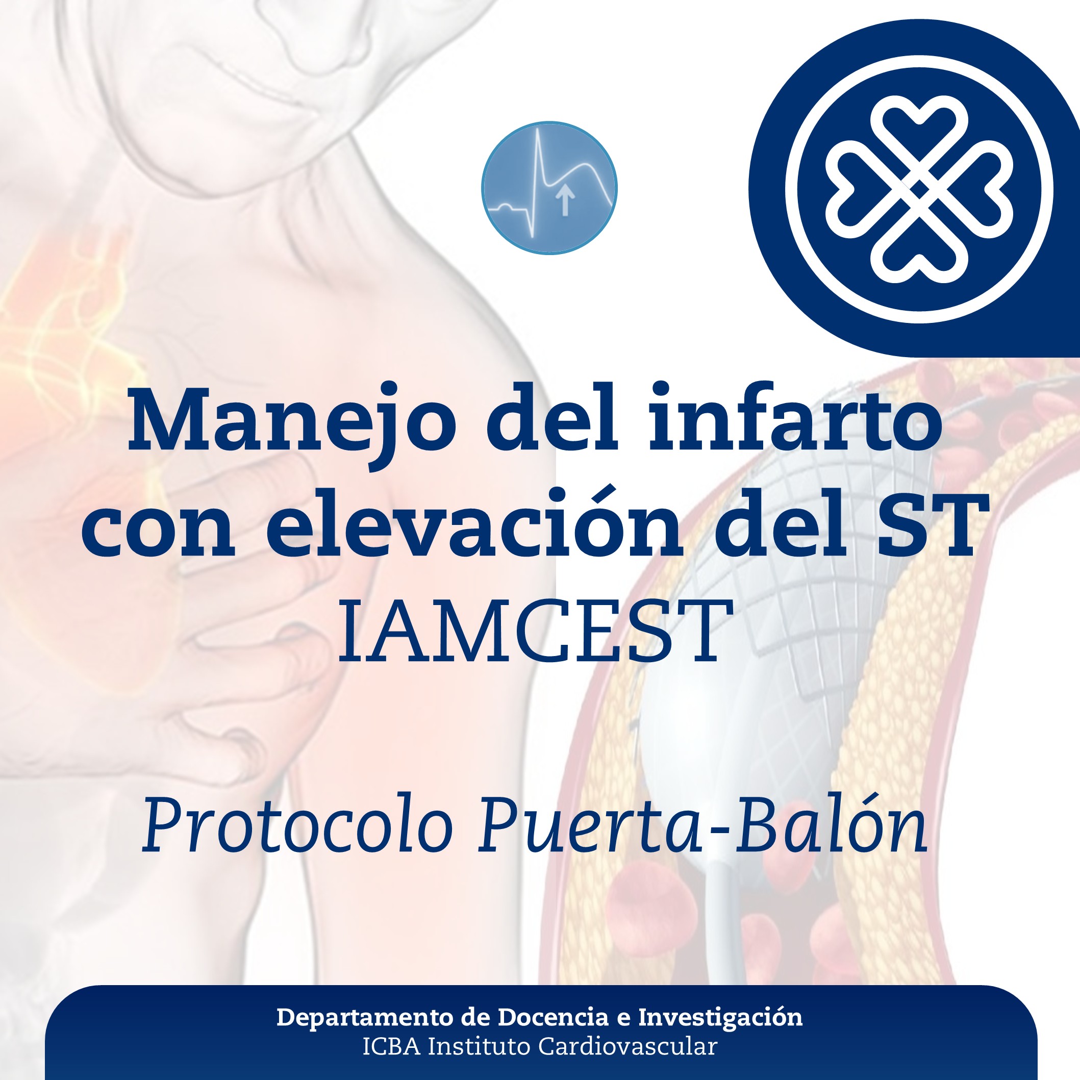 Manejo del infarto con elevación del ST - IAMCEST